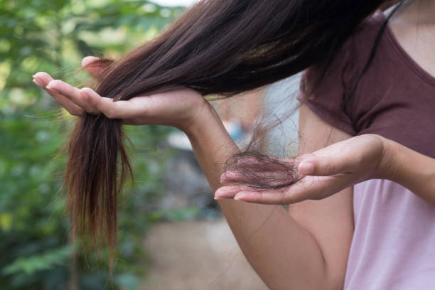 Ayurvedic Treatment For Hair Fall